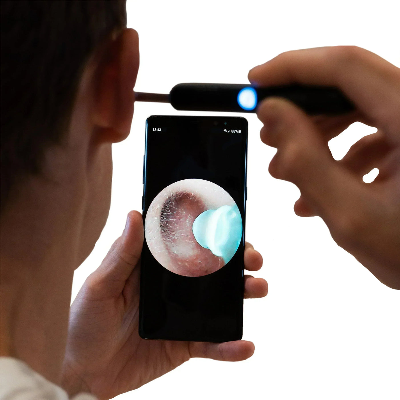 IXORA™   - PROFESSIONAL EAR WAX REMOVAL TOOL